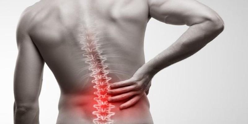 Back Pain and Ordinary Activity: Triggers, Symptom Flares, and Recovery Realities